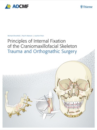 表紙画像: Principles of Internal Fixation of the Craniomaxillofacial Skeleton 1st edition 9783132453180