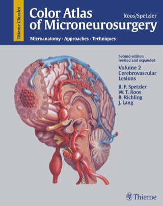 Cover image: Color Atlas of Microneurosurgery: Volume 2 - Cerebrovascular Lesions 2nd edition 9780865774780
