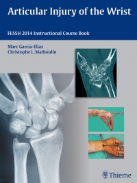 Cover image: Articular Injury of the Wrist 1st edition 9783131746214