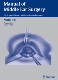 Cover image: Manual of Middle Ear Surgery 1st edition 9780865775893