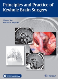 Imagen de portada: Principles and Practice of Keyhole Brain Surgery 1st edition 9783132431911