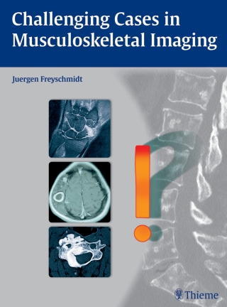 Titelbild: Challenging Cases in Musculoskeletal Imaging 1st edition 9783131764010