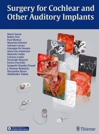 Cover image: Surgery for Cochlear and Other Auditory Implants 1st edition 9783132431904