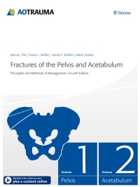 Cover image: Fractures of the Pelvis and Acetabulum 4th edition 9783132006317