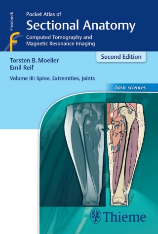 Imagen de portada: Pocket Atlas of Sectional Anatomy, Volume III: Spine, Extremities, Joints 2nd edition 9783131431721