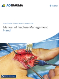 Cover image: Manual of Fracture Management - Hand 1st edition 9783132215818