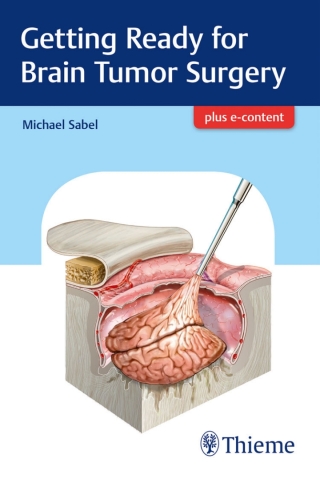 Cover image: Getting Ready for Brain Tumor Surgery 1st edition 9783132409576