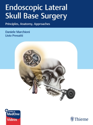 Cover image: Endoscopic Lateral Skull Base Surgery 1st edition 9783132412774