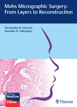 Cover image: Mohs Micrographic Surgery: From Layers to Reconstruction 1st edition 9783132420175