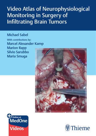 Cover image: Video Atlas of Neurophysiological Monitoring in Surgery of Infiltrating Brain Tumors 1st edition 9783132421462