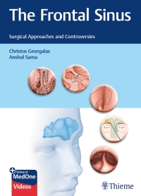 Cover image: The Frontal Sinus 1st edition 9783132400528