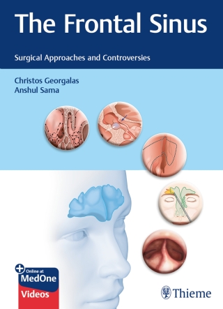 Imagen de portada: The Frontal Sinus 1st edition 9783132400528