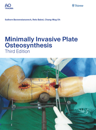 Cover image: Minimally Invasive Plate Osteosynthesis 3rd edition 9783132454255