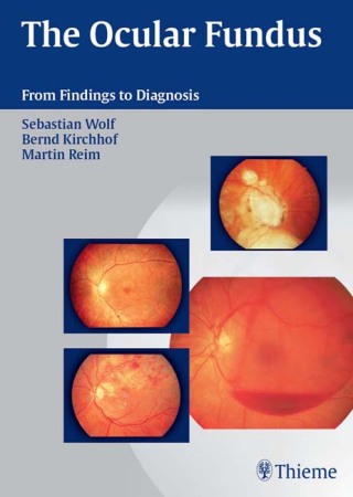 Imagen de portada: The Ocular Fundus 1st edition 9783131393715
