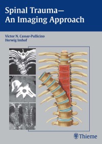 Imagen de portada: Spinal Trauma - An Imaging Approach 1st edition 9783131374714