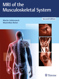 Cover image: MRI of the Musculoskeletal System 2nd edition 9783131165725