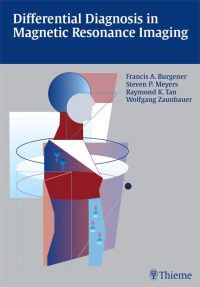 Titelbild: Differential Diagnosis in Magnetic Resonance Imaging 1st edition 9783131081216