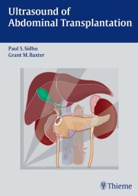 Cover image: Ultrasound of Abdominal Transplantation 1st edition 9783131310811