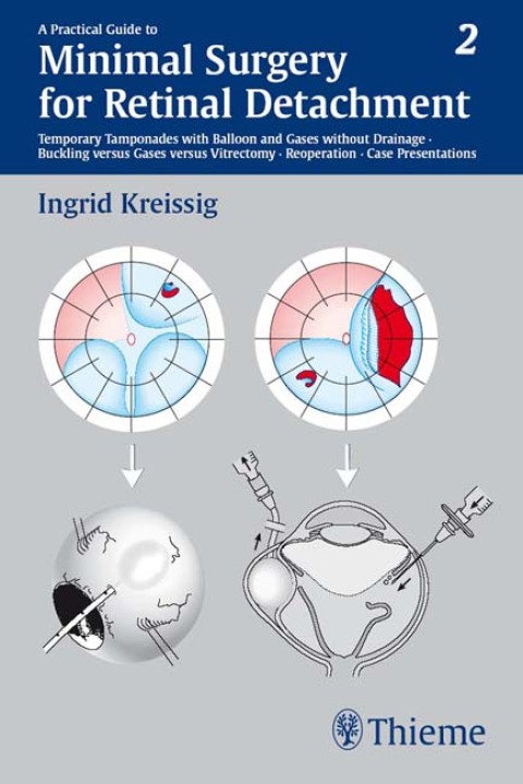 A Practical Guide to Minimal Surgery for Retinal Detachment, Vol. 2: Temporary Tamponades with Balloon and Gases without Drainage, Buckling versus Gases versus Vitrectomy, Reoperation, Case Presentations, 1st Edition - FULL INSTANT DOWNLOAD | PDF DOCX EPUB