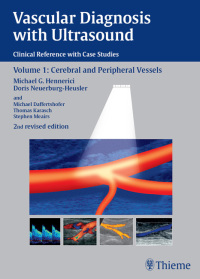 Cover image: Vascular Diagnosis with Ultrasound 2nd edition 9783131038326