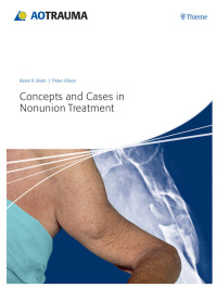 Imagen de portada: Concepts and Cases in Nonunion Treatment 1st edition 9783131658517