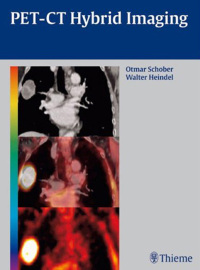 Cover image: PET-CT Hybrid Imaging 1st edition 9783131488619