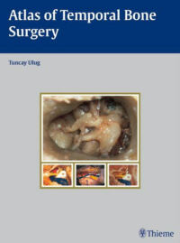 Cover image: Atlas of Temporal Bone Surgery 1st edition 9783131471512