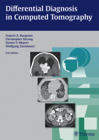 Imagen de portada: Differential Diagnosis in Computed Tomography 2nd edition 9783131025425