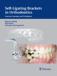 صورة الغلاف: Self-Ligating Brackets in Orthodontics 1st edition 9783131547019