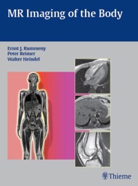 Cover image: MR Imaging of the Body 1st edition 9783131358417