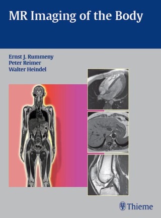 Imagen de portada: MR Imaging of the Body 1st edition 9783131358417