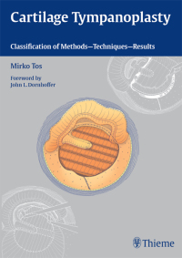 表紙画像: Cartilage Tympanoplasty 1st edition 9783131450913