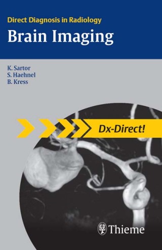 Imagen de portada: Brain Imaging 1st edition 9783131439611