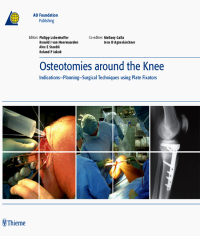 Cover image: Osteotomies around the Knee 1st edition 9783131475312