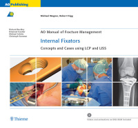 Imagen de portada: AO Manual of Fracture Management: Internal Fixators 1st edition 9783131435514