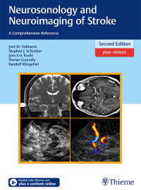 Cover image: Neurosonology and Neuroimaging of Stroke 2nd edition 9783131418722