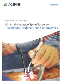 Imagen de portada: Minimally Invasive Spine Surgery - Techniques, Evidence, and Controversies 1st edition 9783131723819