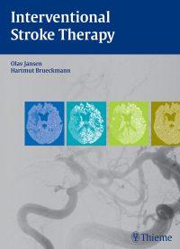 Cover image: Interventional Stroke Therapy 1st edition 9783131699213