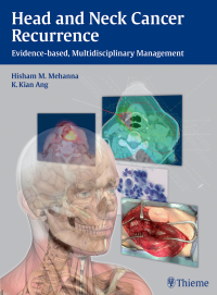 Omslagafbeelding: Head and Neck Cancer Recurrence 1st edition 9783131473912