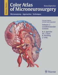 Cover image: Color Atlas of Microneurosurgery: Volume 2 - Cerebrovascular Lesions 2nd edition 9783131111029