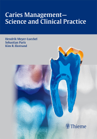 Cover image: Caries Management - Science and Clinical Practice 1st edition 9783131547118