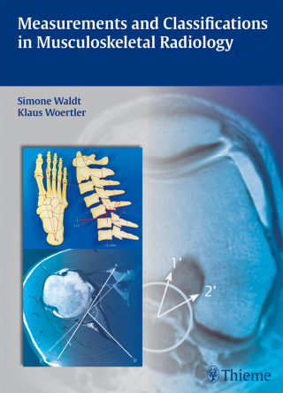 Cover image: Measurements and Classifications in Musculoskeletal Radiology 1st edition 9783131692719