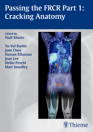 Cover image: Passing the FRCR Part 1: Cracking Anatomy 1st edition 9783131987617