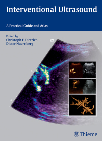 Cover image: Interventional Ultrasound 1st edition 9783131708212