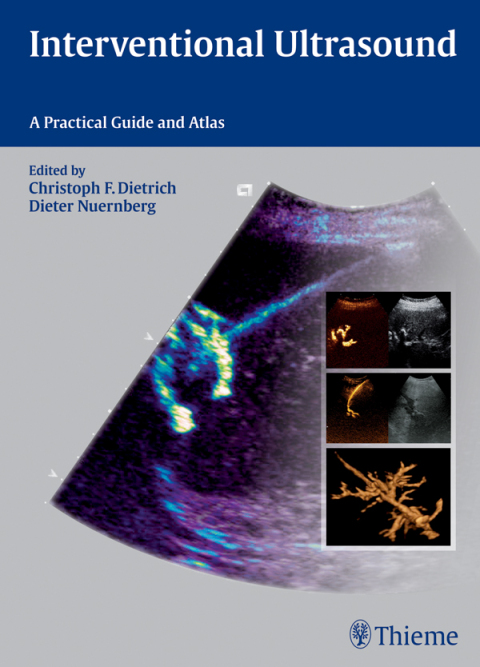 Interventional Ultrasound: A Practical Guide and Atlas, 1st Edition - FULL INSTANT DOWNLOAD | PDF DOCX EPUB