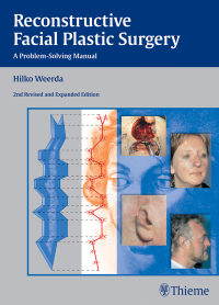 Cover image: Reconstructive Facial Plastic Surgery 2nd edition 9783131296429