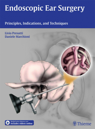 Imagen de portada: Endoscopic Ear Surgery 1st edition 9783131630414