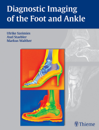 Cover image: Diagnostic Imaging of the Foot and Ankle 1st edition 9783131764614