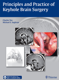 Cover image: Principles and Practice of Keyhole Brain Surgery 1st edition 9783132431911