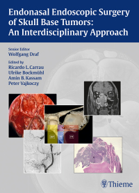 Immagine di copertina: Endonasal Endoscopic Surgery of Skull Base Tumors: An Interdisciplinary Approach 1st edition 9783131546715